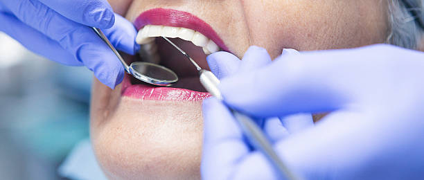 Best Emergency Gum Treatment in Orange, CA
