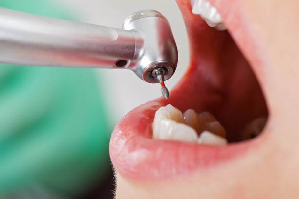Best Pediatric Emergency Dentist in Orange, CA